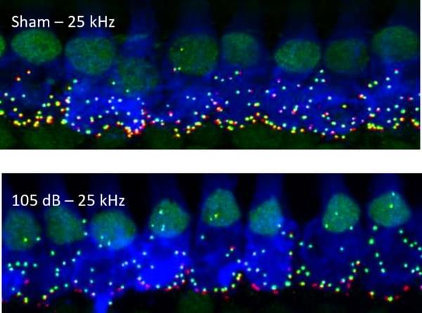 シルケアの事例画像