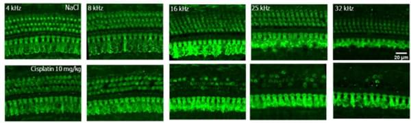 シルケアの事例画像